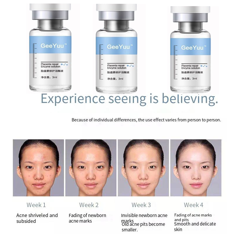 Placent Peptide Ampoule Hyalur – Placenta Extract Serum recenzja i cena