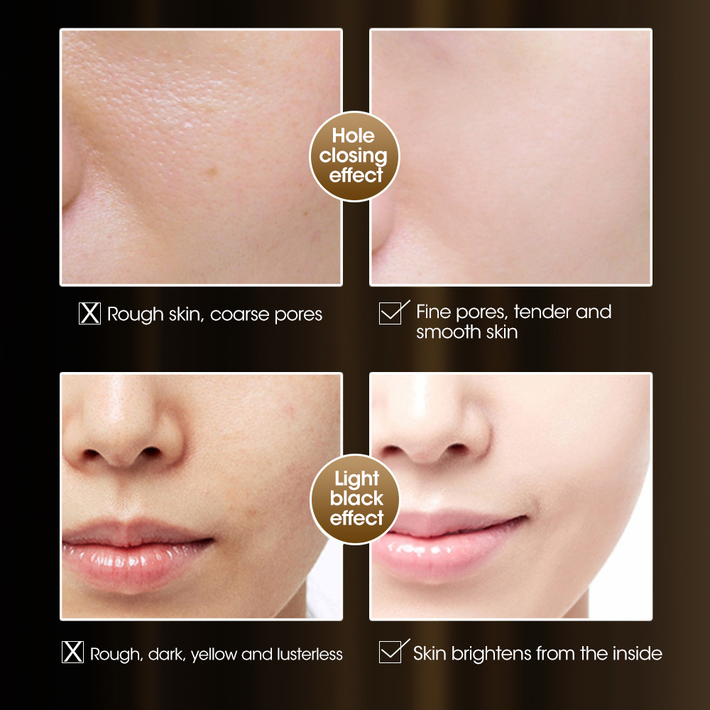 30/60PCS Fullerene Placenta Ca – Placenta Extract Serum recenzja i cena