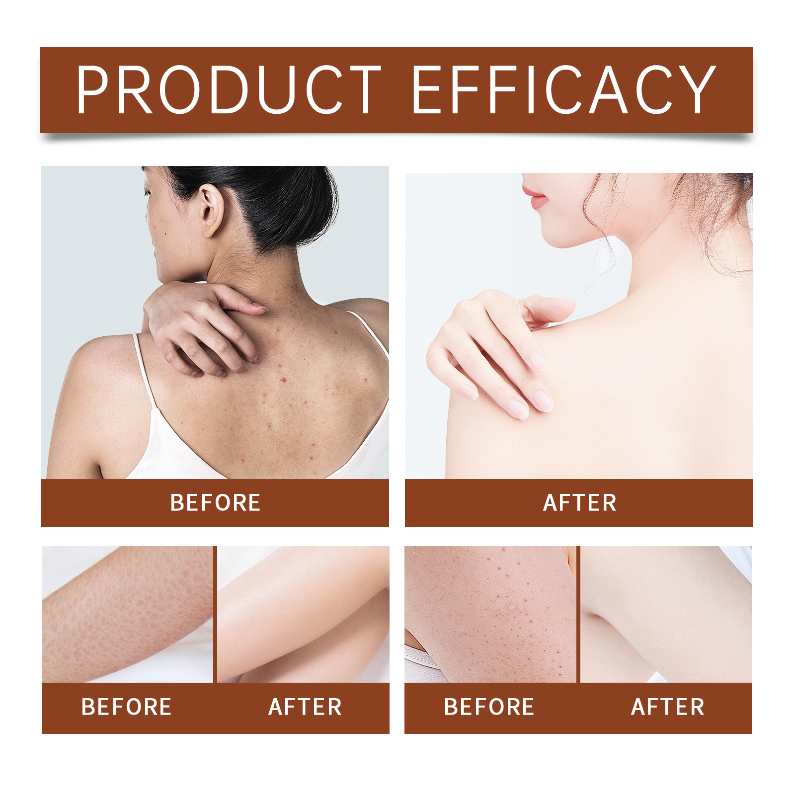 Luxury Body Oil for Dry Skin A – Luxury Skincare Moisturizer recenzja i cena